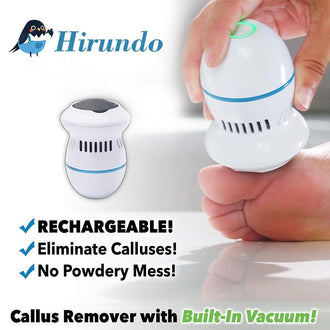 Hirundo Foot File and Callus Remover - mygeniusgift