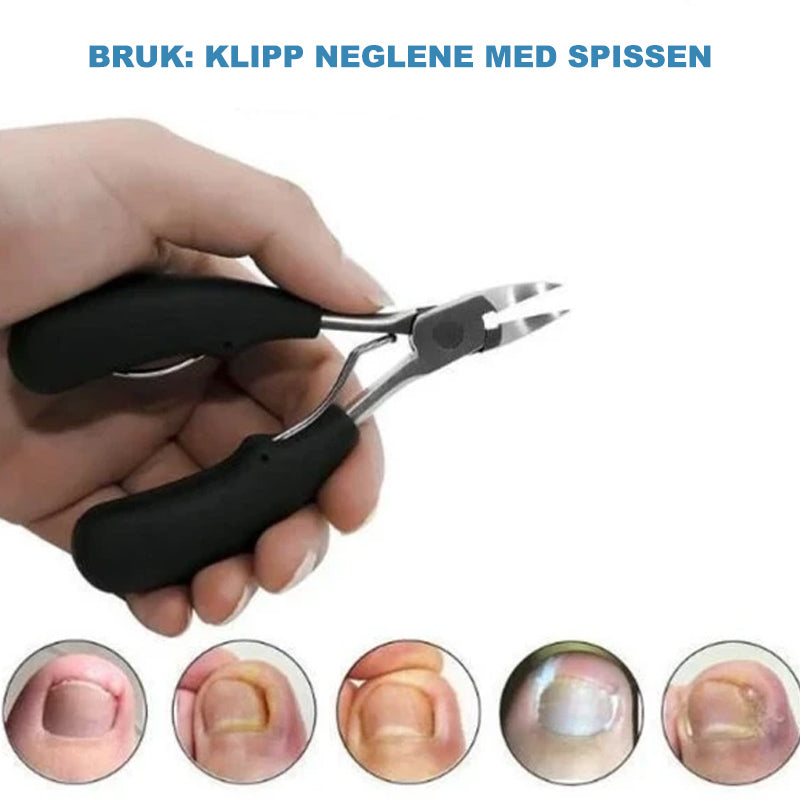 Negleklippere av medisinsk karakter