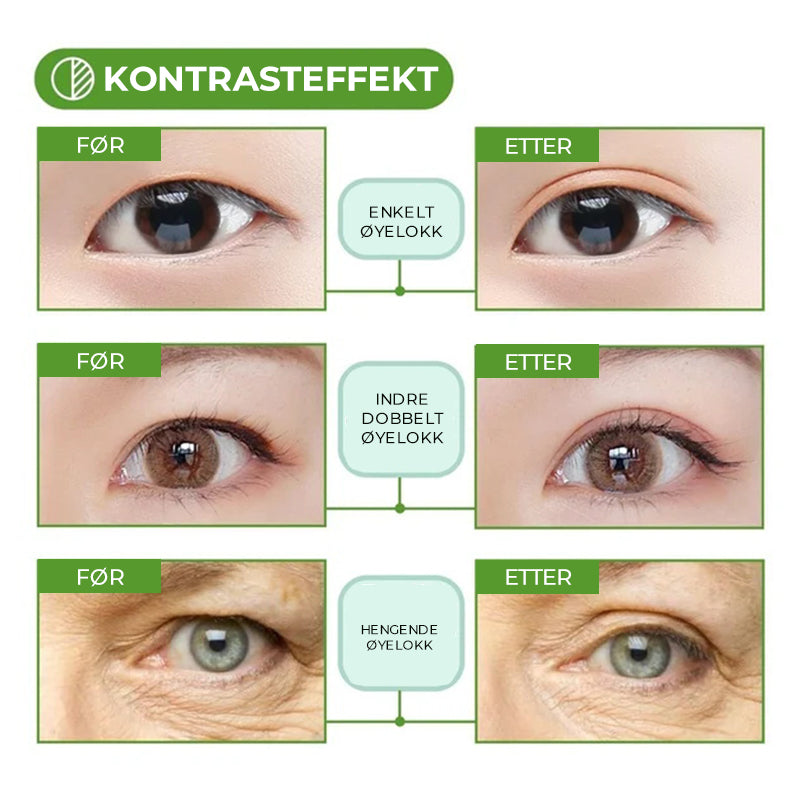 Usynlige doble øyelokkstrips