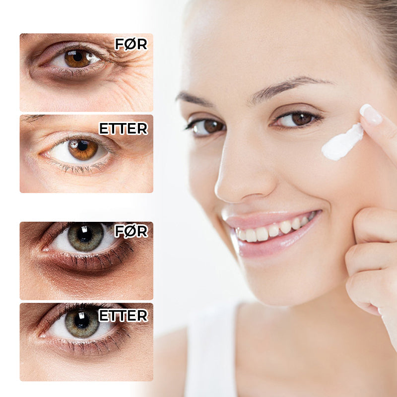 Retinol øyekrempinne